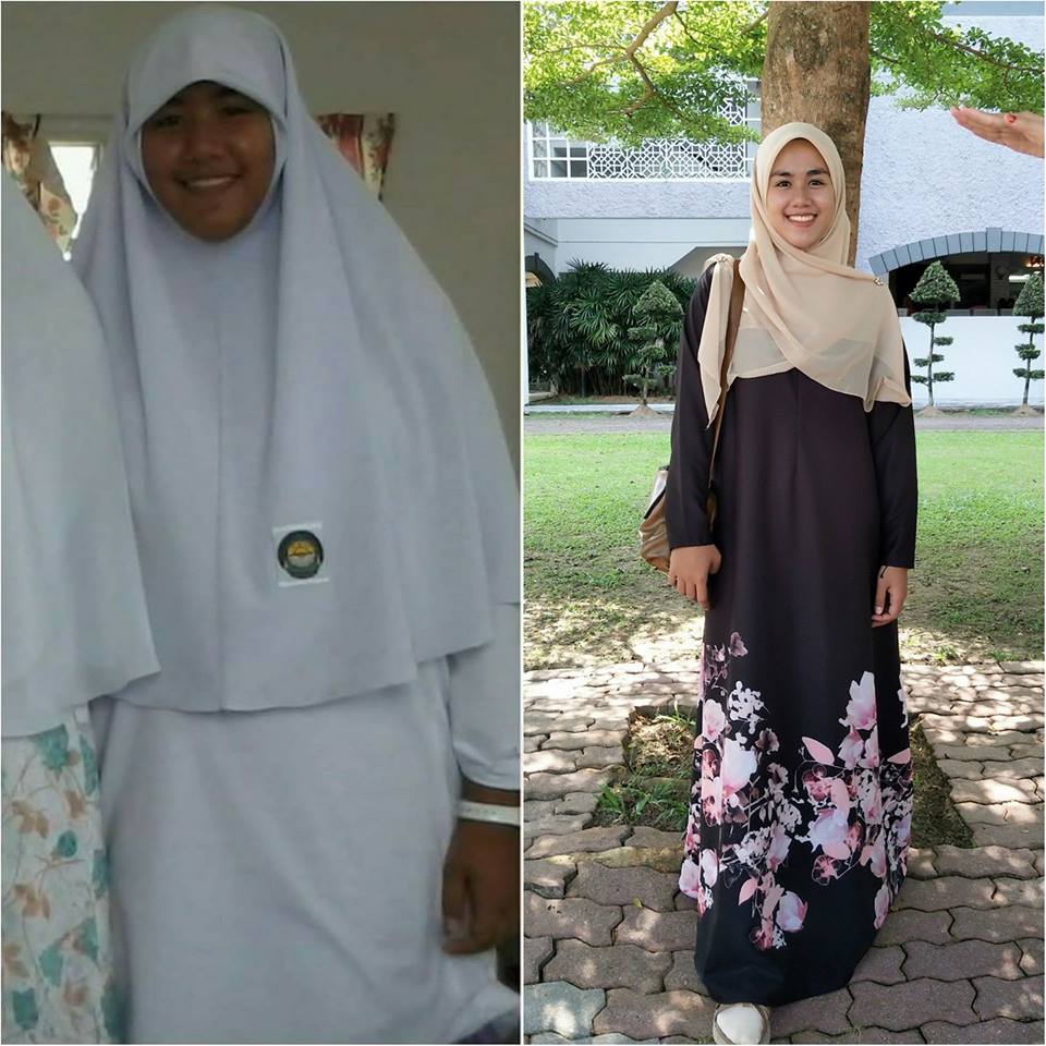Wajah Pernah Menggerutu Sebab Breakout, Penampilan Gadis ...